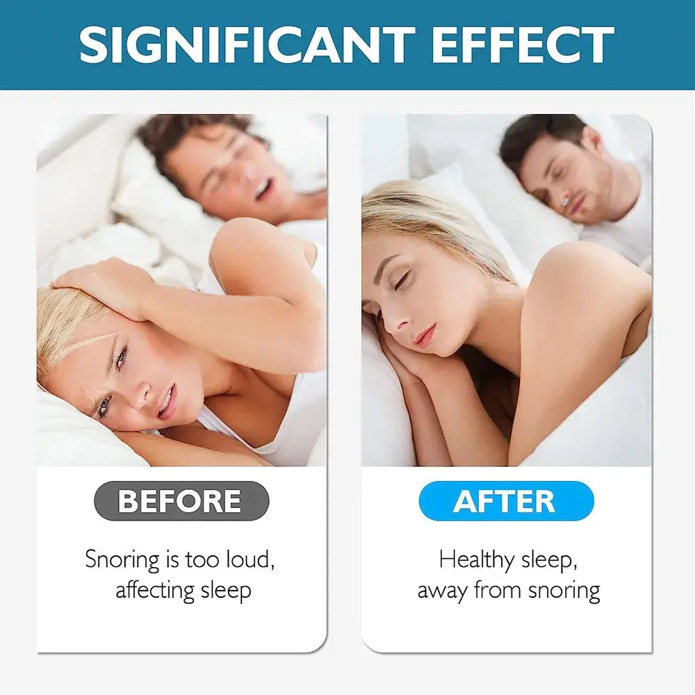 Anti Snoring Devices Silicone Magnetic